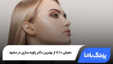 بهترین دکتر زاویهسازی در مشهد