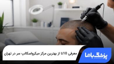 بهترین مرکز میکرواسکالپ سر در تهران
