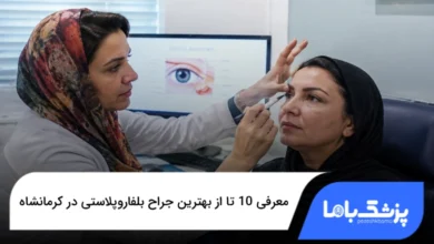 بهترین جراح بلفاروپلاستی در کرمانشاه