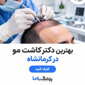 بهترین دکتر کاشت مو در کرمانشاه