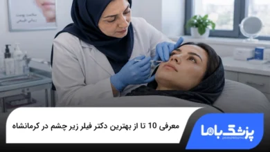 بهترین دکتر فیلر زیر چشم در کرمانشاه