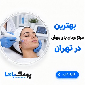 بهترین مرکز درمان جای جوش در تهران