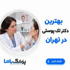 بهترین دکتر لک پوستی در تهران