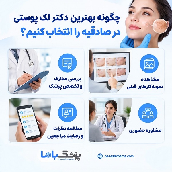 چگونه بهترین دکتر لک پوستی در صادقیه را انتخاب کنیم؟