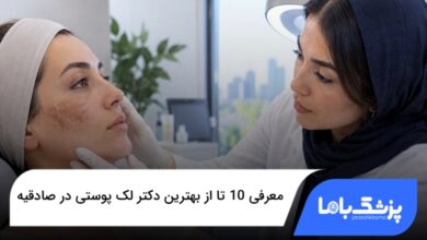 بهترین دکتر لک پوستی در صادقیه