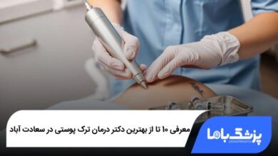 بهترین دکتر درمان ترک پوستی در سعادت آباد