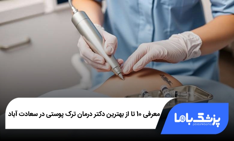 بهترین دکتر درمان ترک پوستی در سعادت آباد