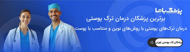 اهمیت مشاوره پزشکی قبل از درمان ترک پوستی