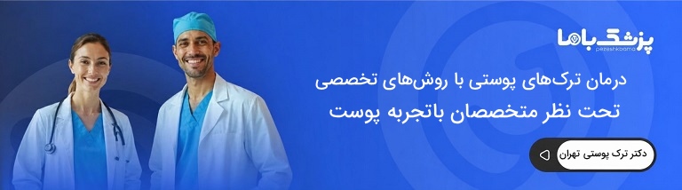بهترین دکتر درمان ترک پوستی در تهران