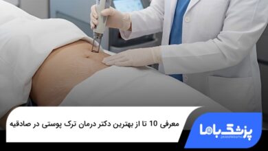 بهترین دکتر درمان ترک پوستی در صادقیه