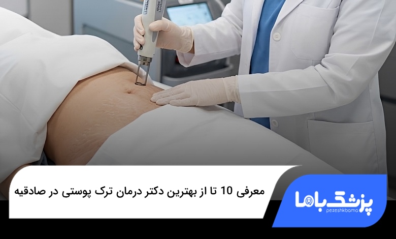 بهترین دکتر درمان ترک پوستی در صادقیه