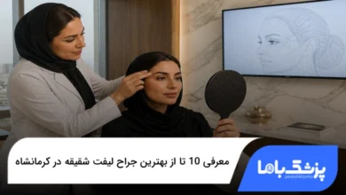 بهترین جراح لیفت شقیقه در کرمانشاه