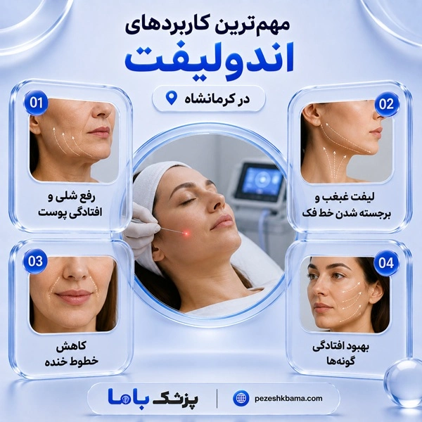 مهمترین کاربردهای اندولیفت در کرمانشاه