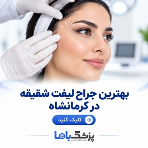 بهترین جراح لیفت شقیقه در کرمانشاه