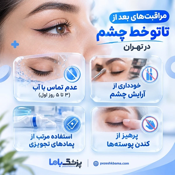 مراقبتهای بعد از تاتو خط چشم در تهران