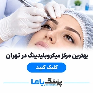 بهترین مرکز میکروبلیدینگ در تهران