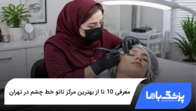 بهترین مرکز تاتو خط چشم در تهران