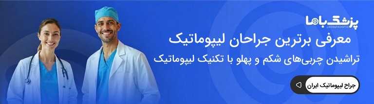 بهترین دکتر لیپوماتیک در ایران