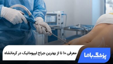 بهترین جراح لیپوماتیک در کرمانشاه