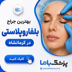 بهترین جراح بلفاروپلاستی در کرمانشاه