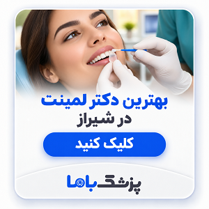 بهترین دکتر لمینت در شیراز