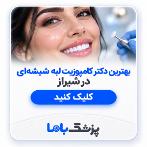 بهترین دکتر کامپوزیت لبه شیشهای در شیراز