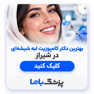 بهترین دکتر کامپوزیت لبه شیشهای در شیراز