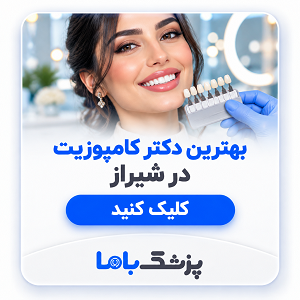 بهترین دکتر کامپوزیت در شیراز