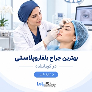 بهترین جراح بلفاروپلاستی در کرمانشاه