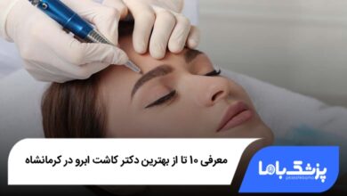 بهترین دکتر کاشت ابرو در کرمانشاه