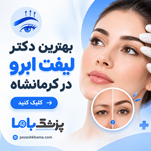 بهترین دکتر لیفت ابرو در کرمانشاه