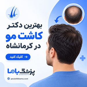 بهترین دکتر کاشت مو در کرمانشاه