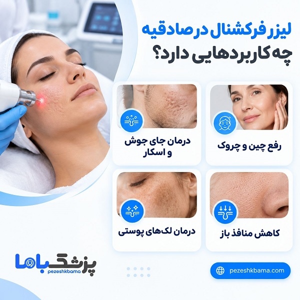 لیزر فرکشنال در صادقیه چه کاربردهایی دارد؟