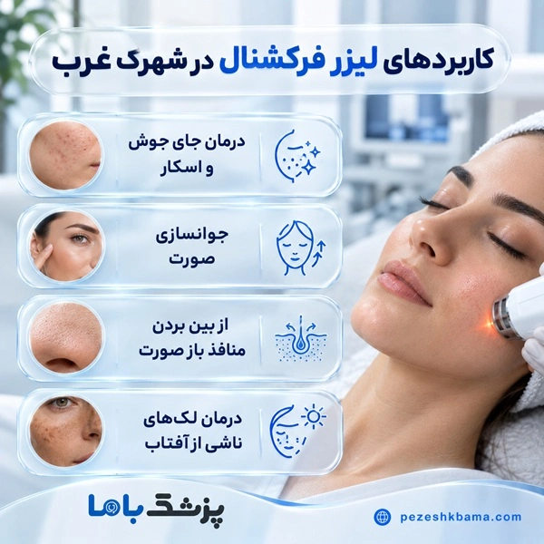 کاربردهای لیزر فرکشنال در شهرک غرب