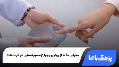 بهترین جراح ماموپلاستی در کرمانشاه