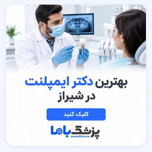 بهترین دکتر ایمپلنت در شیراز