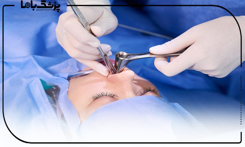 جراحی بینی استخوانی مدل طبیعی در کرمانشاه