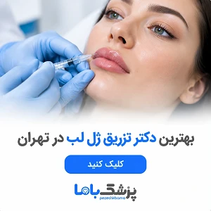 بهترین دکترر تزریق ژل لب در تهران