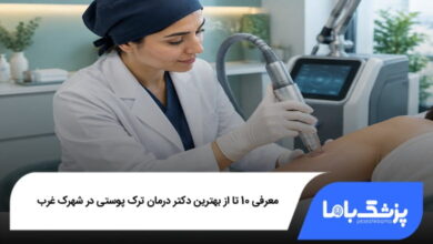 بهترین دکتر درمان ترک پوستی در شهرک غرب