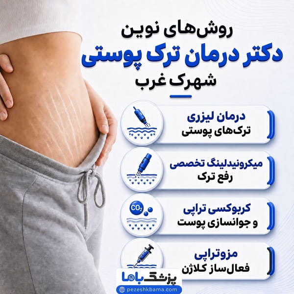 روش های نوین دکتر درمان ترک پوستی شهرک غرب