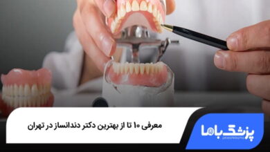 بهترین دکتر دندانساز در تهران
