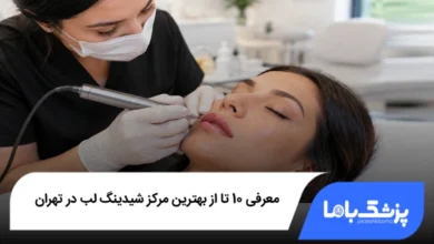 بهترین مرکز شیدینگ لب در تهران