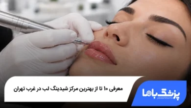 بهترین مرکز شیدینگ لب در غرب تهران