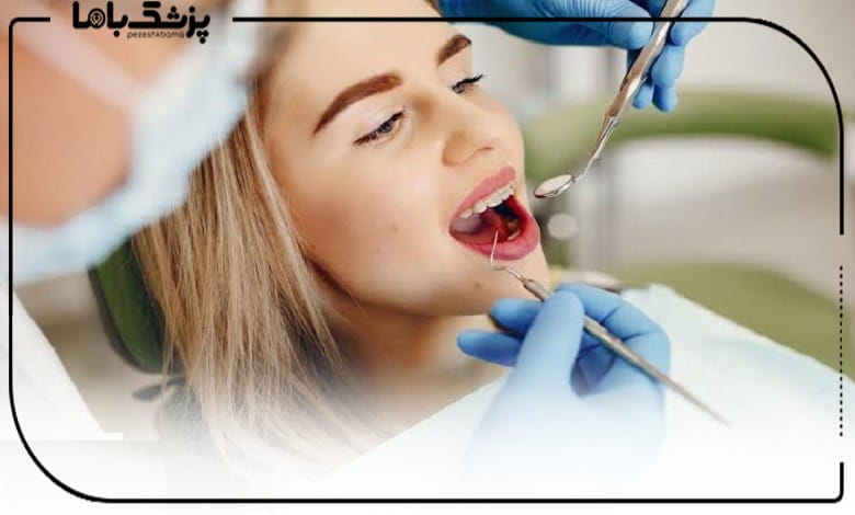 خدمات بهترین متخصص عصبکشی در تهران