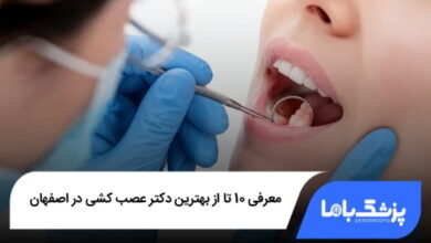 بهترین دکتر عصب کشی در اصفهان