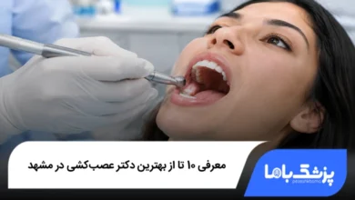 بهترین دکتر عصب کشی در مشهد