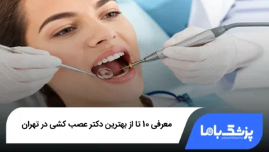 بهترین دکتر عصب کشی در تهران