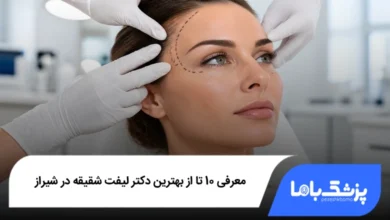 بهترین دکتر لیفت شقیقه در شیراز