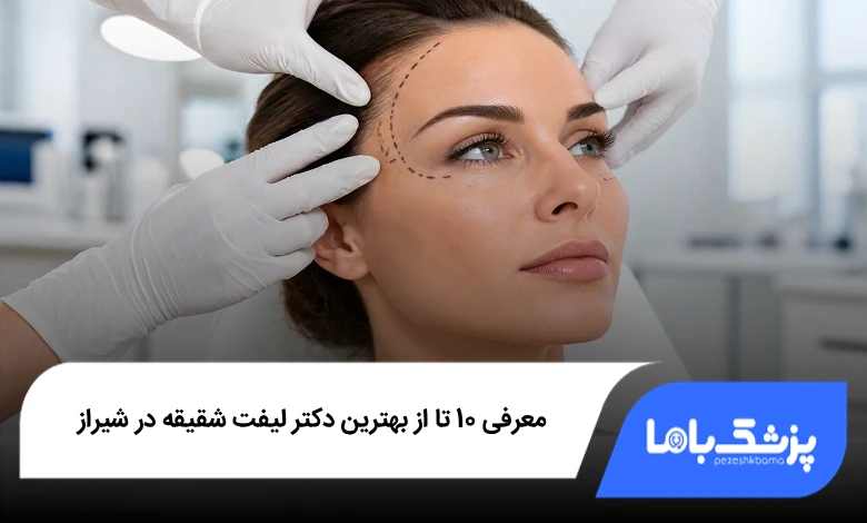 بهترین دکتر لیفت شقیقه در شیراز