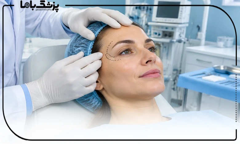 جراحی لیفت شقیقه یا لیفت با نخ ؛ کدام بهتر است؟